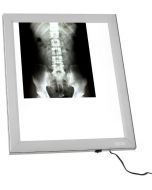 Negativoscopio verticale X-ray a LED - 42X49 Cm